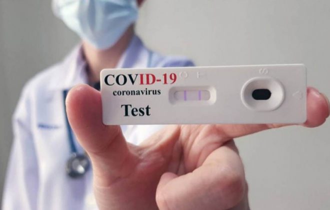 El resultado de los autotest de coronavirus se deberá notificar a las farmacias