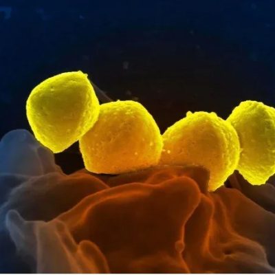 Streptococcus pyogenes: aumentan los casos y ya hay 93 muertos
