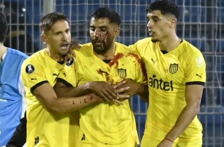 Fútbol: Rosario Central podría sufrir un duro castigo tras los incidentes con Peñarol