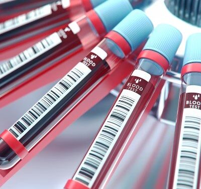 Un test de sangre revela la edad de los órganos y podría predecir enfermedades
