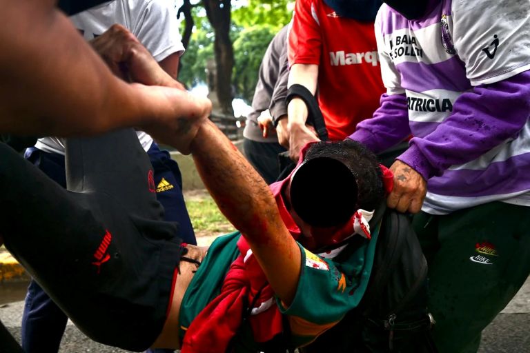 Bullrich dijo sobre el fotógrafo en estado crítico que “es consecuencia de los que generan violencia y que van a tener como respuesta la represión del Estado”