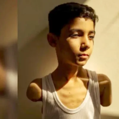 Una imagen que conmueve al mundo: niño mutilado en Gaza es la Foto del Año 2025