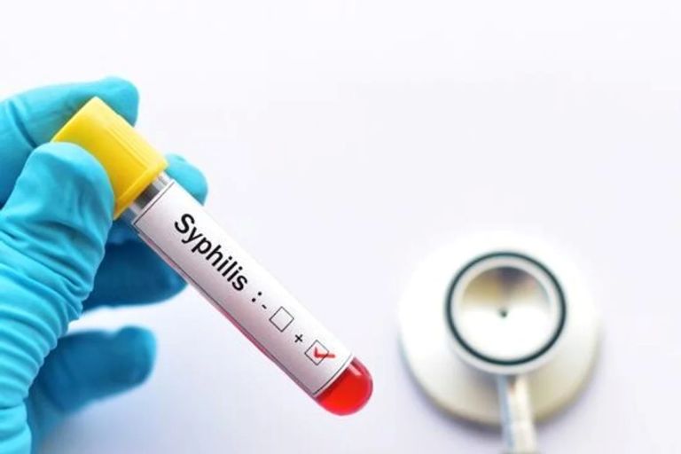 Preocupa el avance de la sífilis, se triplicaron los casos en adolescentes y recién nacidos